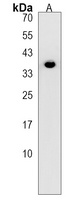 PANK1 Rabbit Polyclonal Antibody