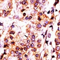 PANK1 Rabbit Polyclonal Antibody