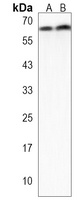 GALK2 Rabbit Polyclonal Antibody
