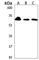 PKC eta Rabbit Polyclonal Antibody
