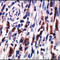 PKC eta Rabbit Polyclonal Antibody