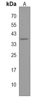 DLX2 Rabbit Polyclonal Antibody