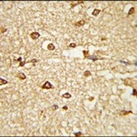 DLX2 Rabbit Polyclonal Antibody