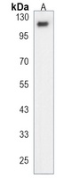 ESPN Rabbit Polyclonal Antibody
