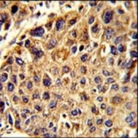 SPCS3 Rabbit Polyclonal Antibody