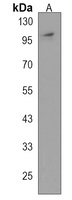 MTBP Rabbit Polyclonal Antibody