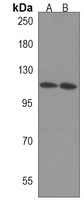 CTDP1 Rabbit Polyclonal Antibody