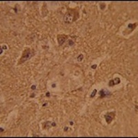 CTDP1 Rabbit Polyclonal Antibody