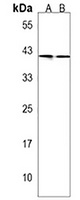 Gamma-Actin Rabbit Polyclonal Antibody