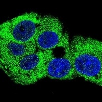 Gamma-Actin Rabbit Polyclonal Antibody