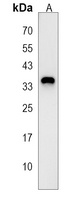 RCAN3 Rabbit Polyclonal Antibody