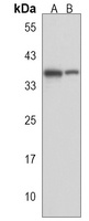 PARP16 Rabbit Polyclonal Antibody
