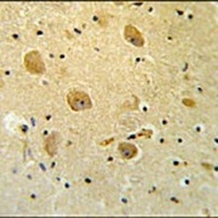 PARP16 Rabbit Polyclonal Antibody