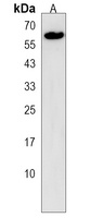 MAGED2 Rabbit Polyclonal Antibody
