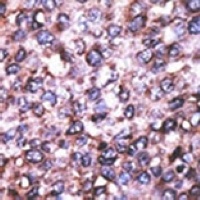 MAGED2 Rabbit Polyclonal Antibody