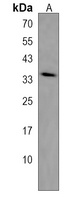 MAGEA2 Rabbit Polyclonal Antibody