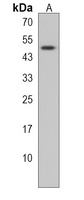DDI2 Rabbit Polyclonal Antibody