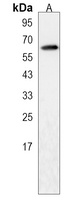 RTKN2 Rabbit Polyclonal Antibody