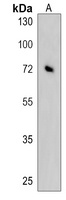 KLHL6 Rabbit Polyclonal Antibody
