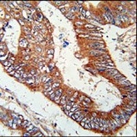 KLHL6 Rabbit Polyclonal Antibody
