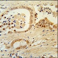 ZNF385B Rabbit Polyclonal Antibody