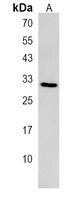 EMC3 Rabbit Polyclonal Antibody