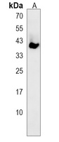 CCNYL1 Rabbit Polyclonal Antibody