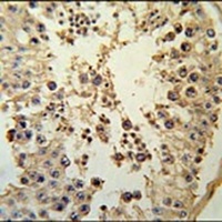 CCNYL1 Rabbit Polyclonal Antibody