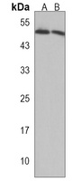 LCLAT1 Rabbit Polyclonal Antibody