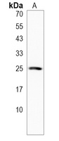 LHFPL3 Rabbit Polyclonal Antibody