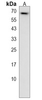 N4BP3 Rabbit Polyclonal Antibody