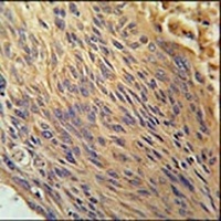 CPEB4 Antibody