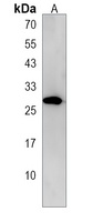 KCT2 Rabbit Polyclonal Antibody