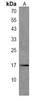 C1orf95 Rabbit Polyclonal Antibody