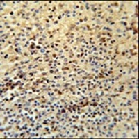 SPATA13 Rabbit Polyclonal Antibody