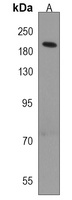 DIP2A Rabbit Polyclonal Antibody