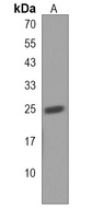 PLET1 Rabbit Polyclonal Antibody