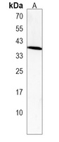 TaR-5 Rabbit Polyclonal Antibody