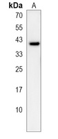 OR5A1 Rabbit Polyclonal Antibody