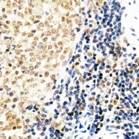 SUZ12 Rabbit Polyclonal Antibody