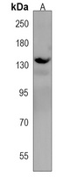 ATP2B3 Rabbit Polyclonal Antibody