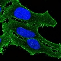 ATP2B3 Rabbit Polyclonal Antibody