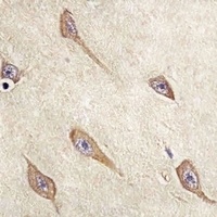 FAM168B Rabbit Polyclonal Antibody
