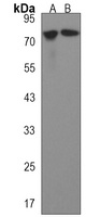 AACS Rabbit Polyclonal Antibody