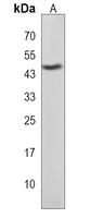 LHX5 Rabbit Polyclonal Antibody