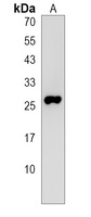 NOTO Rabbit Polyclonal Antibody