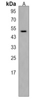 HS6ST2 Rabbit Polyclonal Antibody