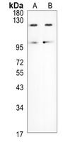 LIFR Rabbit Polyclonal Antibody