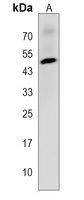CHST12 Rabbit Polyclonal Antibody