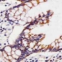 CHST12 Rabbit Polyclonal Antibody